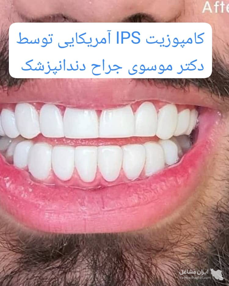 مطب تخصصی ایمپلنت و کامپوزیت دندان دکتر موسوی در تهرانپارس تهران